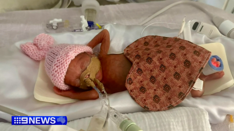Australia’s Most Premature Baby Ever Was Born at 22 Weeks