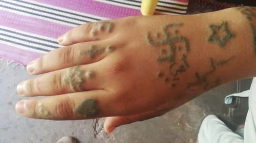 Tattoos on the hand of a Moroccan girl who was tormented in a two-month ordeal.