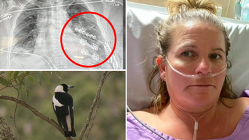 Gold Coast woman attacked by magpie