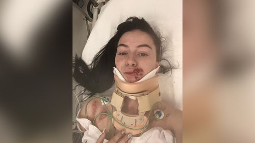 The teenager said she still has to undergo some surgery for her injuries. Picture: Supplied.