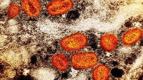 The monkeypox virus is seen through a micropscope.