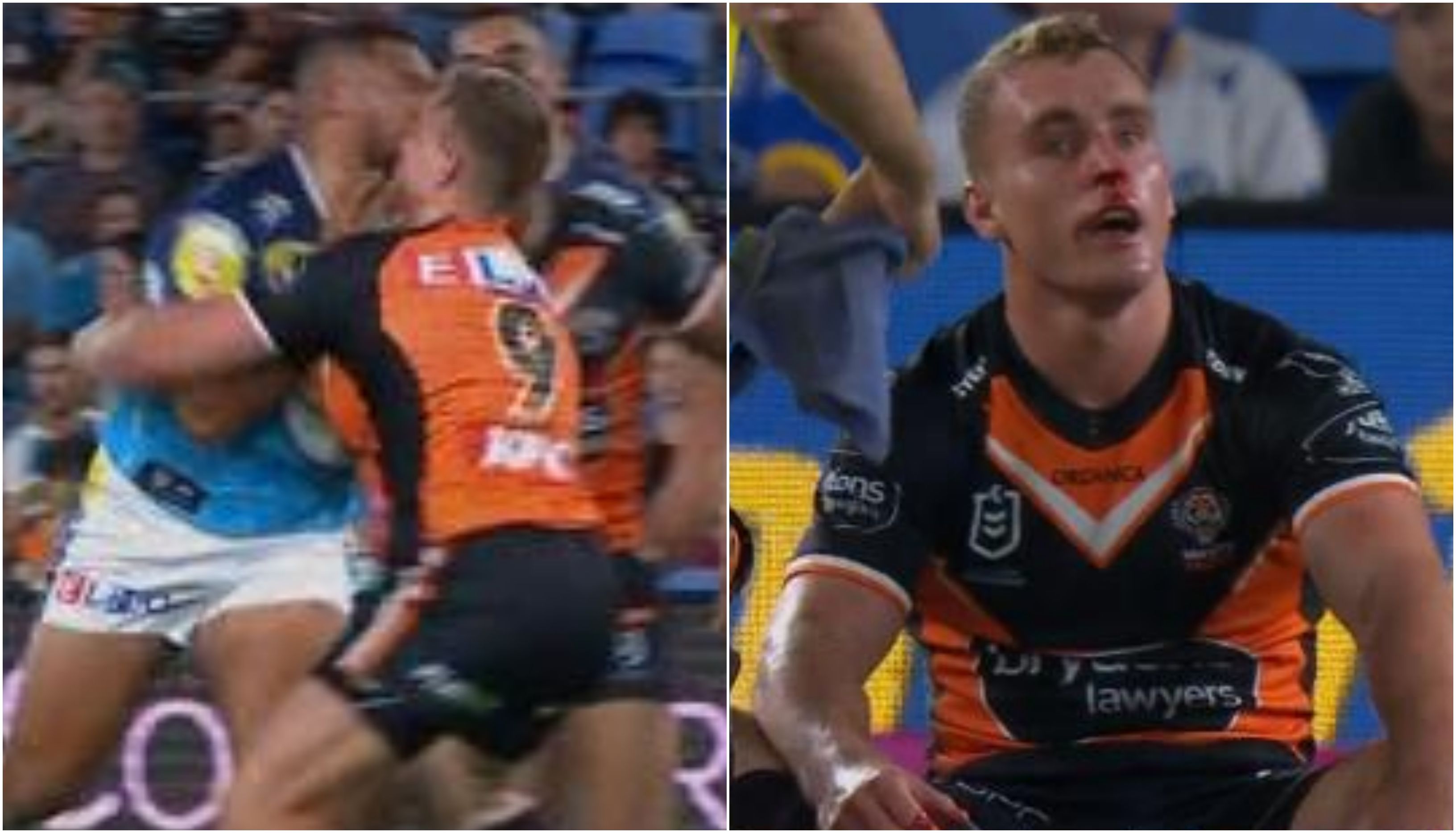 Tiger Jacob Liddle suffers broken nose in nasty collision, plays on