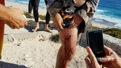 The surfer suffered a deep gash to his thigh. (9NEWS)