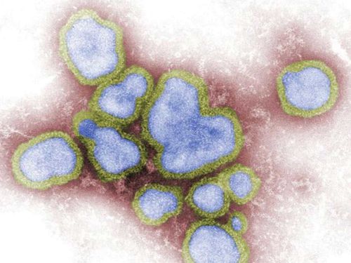 Influenza A is a particularly nasty virus spreading in Australia.