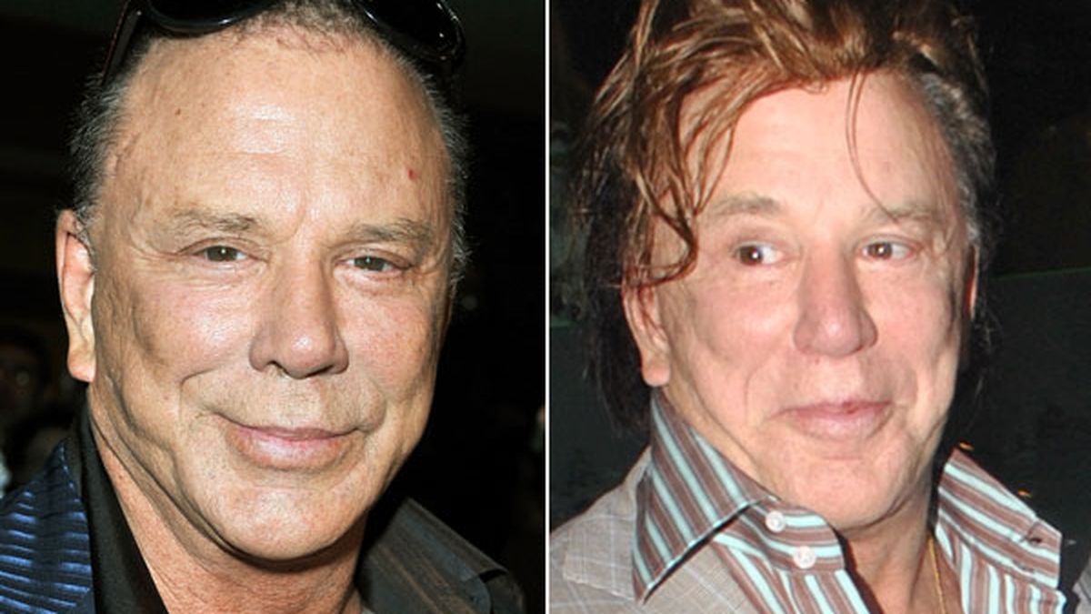 Mickey to what rourke happened Mickey Rourke