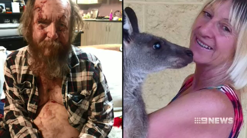 Linda Smith underwent surgery for a collapsed lung this afternoon after a kangaroo attacked her.