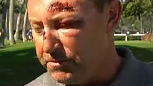 Robert Allenby still has nightmares over Hawaii bashing and robbery