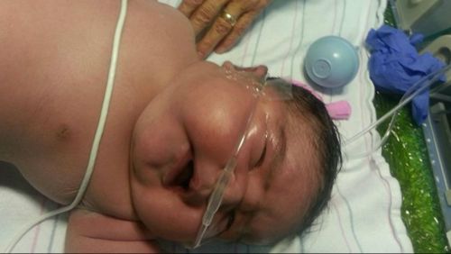 Baby Mia was treated for breathing problems when she was born but is now reportedly doing well. (Supplied)
