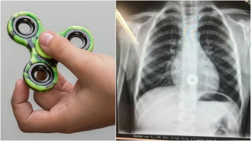 Fidget spinner warning after Sydney boy swallows fad toy’s loose disc 