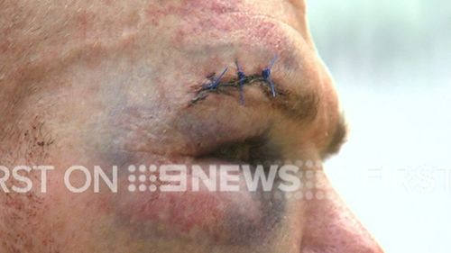 The Queensland man sustained injuries also. (9NEWS)