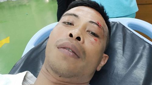 Bali bouncer Adni Junus Liu  allegedly punched by Australian teen Zac William Whiting 1