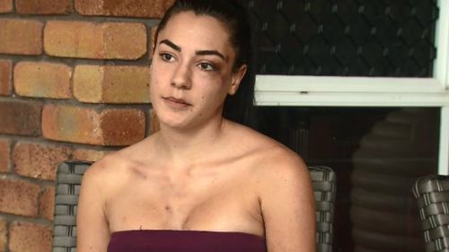 Nicole Mauger has visible bruising on her face and chest, left arm and shoulder. (9NEWS)