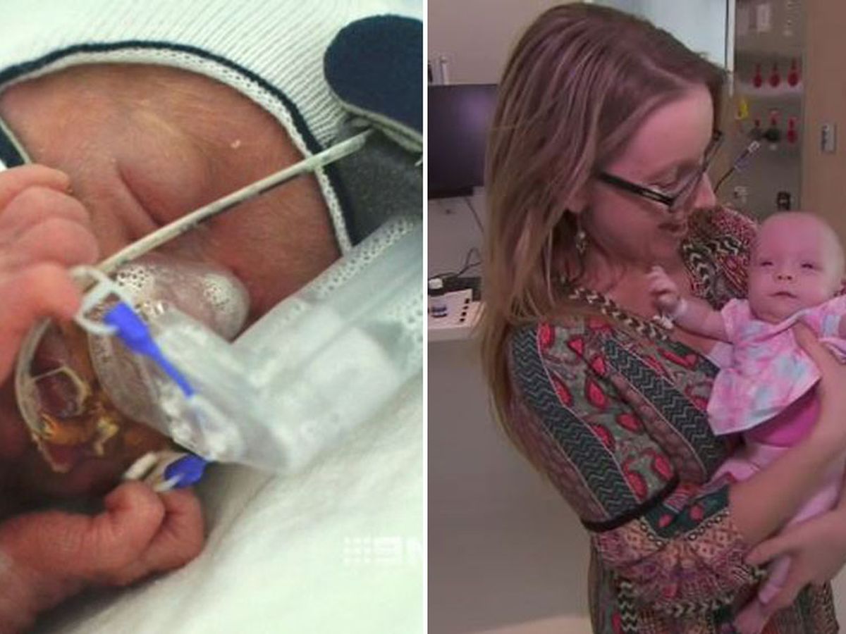 World First discovery in tiny babies - Monash Children's Hospital