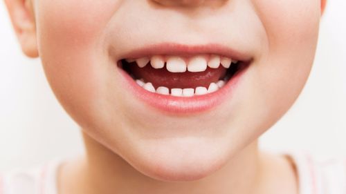 Tooth decay in South Australian kids on the rise