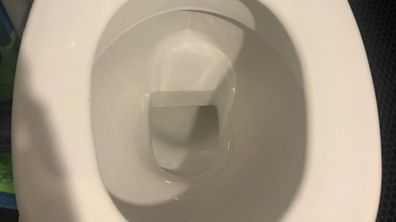 4 Ways To Remove Gross Brown Toilet Stains