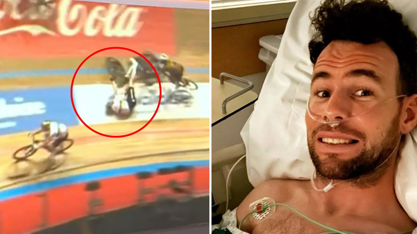 'In a bit of pain': Champion British cyclist Mark Cavendish hospitalised  after horror crash