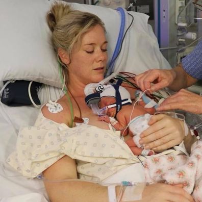 Sam Squiers with daughter Imogen after her premature birth.