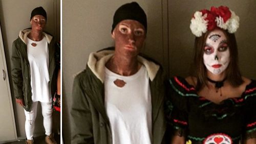 Opals star Alice Kunek says sorry after posting photo of herself in blackface as 'Kanye West'