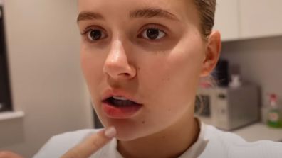Molly-Mae's lips were noticeably smaller after the treatment, with the star adding that they were still a bit swollen, and would in time become even smaller.