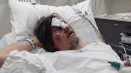 Mathew Lyons, 46, was repeatedly punched and kicked to the head while walking home from the Mid Valley Shopping Centre.