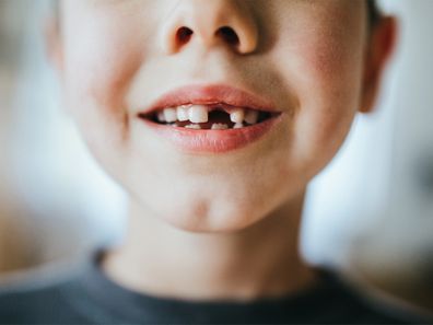 Boy with no front tooth