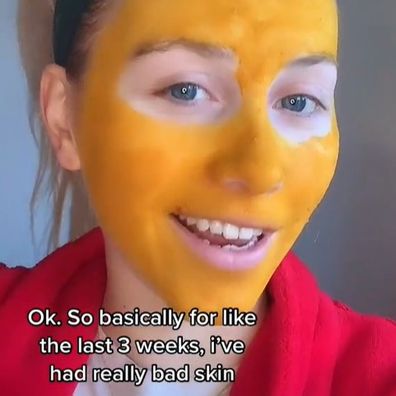 Woman's home face mask remedy dyes her skin bright yellow