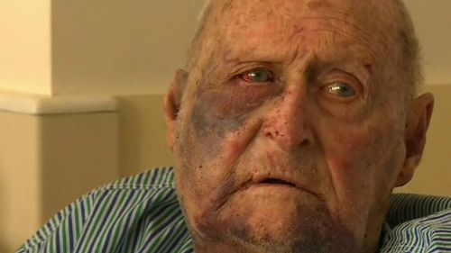 Mr Dilger was left with a fractured eye socket and a broken nose and jaw. (9NEWS)