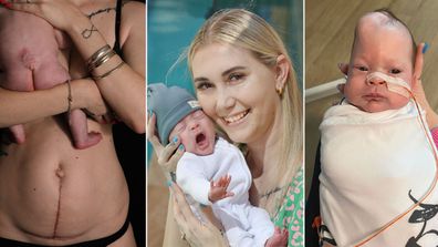 Doctors perform miracle surgery on baby Ethan while in his mum Carly's womb