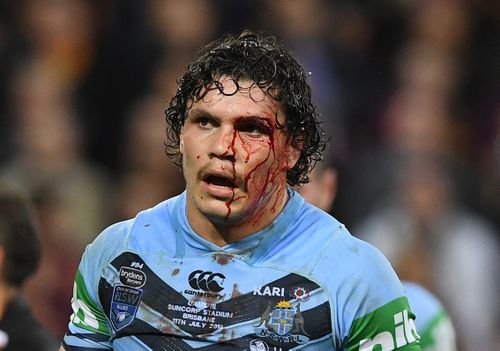 James Roberts was also left bloodied and bruised during the game as the tackles strengthened. Picture: Getty.