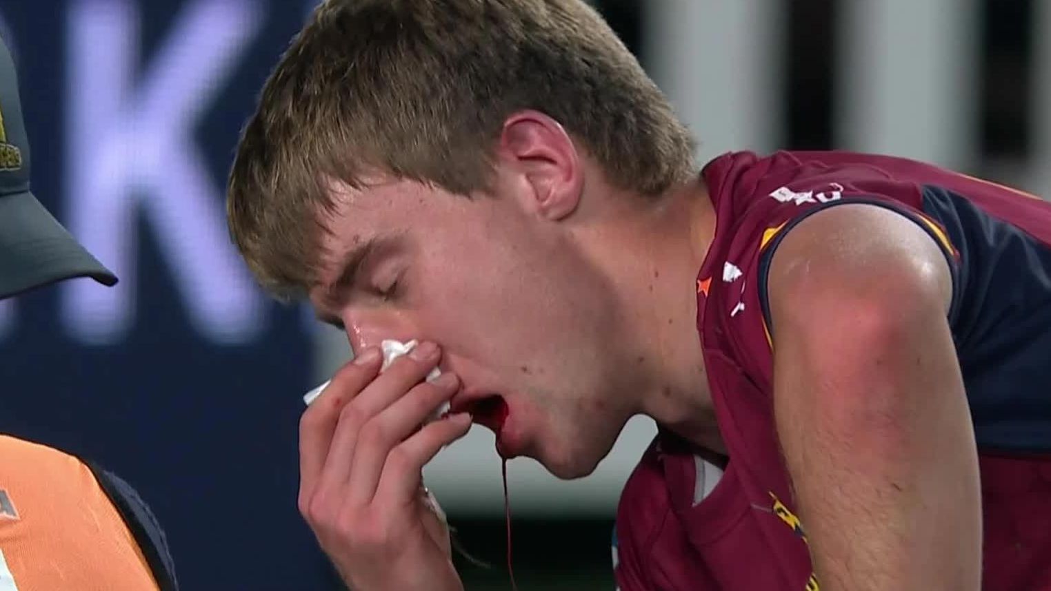 Blood pours from the mouth of Highlanders player Cameron Miller.