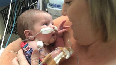 Her mum wasn’t able to cuddle her for the first nine days of her life, which she said was “horrible.”