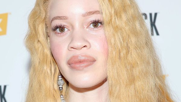 Albino Model Breaks Beauty Barriers 9style