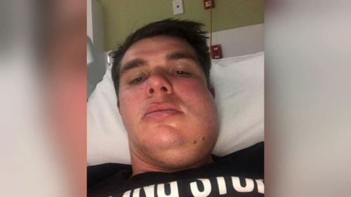 Trinity Old Scholars player Carl Teusner, who's jaw was broken in two places during the game, has reported the incident to Police.

