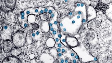 An electron microscope image shows the spherical particles of the new coronavirus, coloured blue, from the first US case of COVID-19.