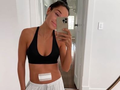 Kayla Itsines with a bandage on her stomach after endometriosis surgery.