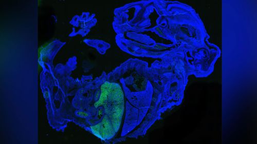 Scientists create a mouse embryo that's part human