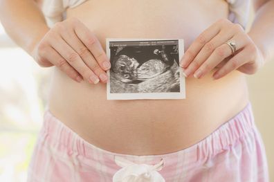 Pregnant woman holding ultrasound photo over belly