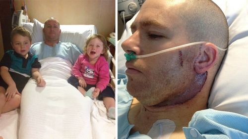 Father of two Lucas Ridgway had all of the lymph nodes removed from the left side of his neck after being diagnosed with stage 3 melanoma in 2015.