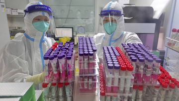 Workers handle swab samples for COVID-19 tests at a hospital lab in Yantai