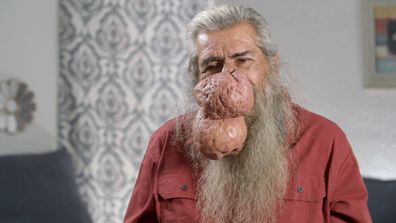 Dr Pimple Popper Rodger 