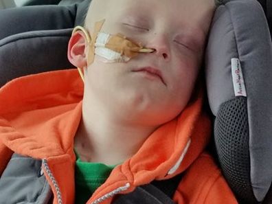 James sleeping after a treatment.