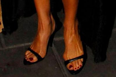 Can this posh Brit expect anything less than bunions if all she wears is high-fash heels? <br/><br/>