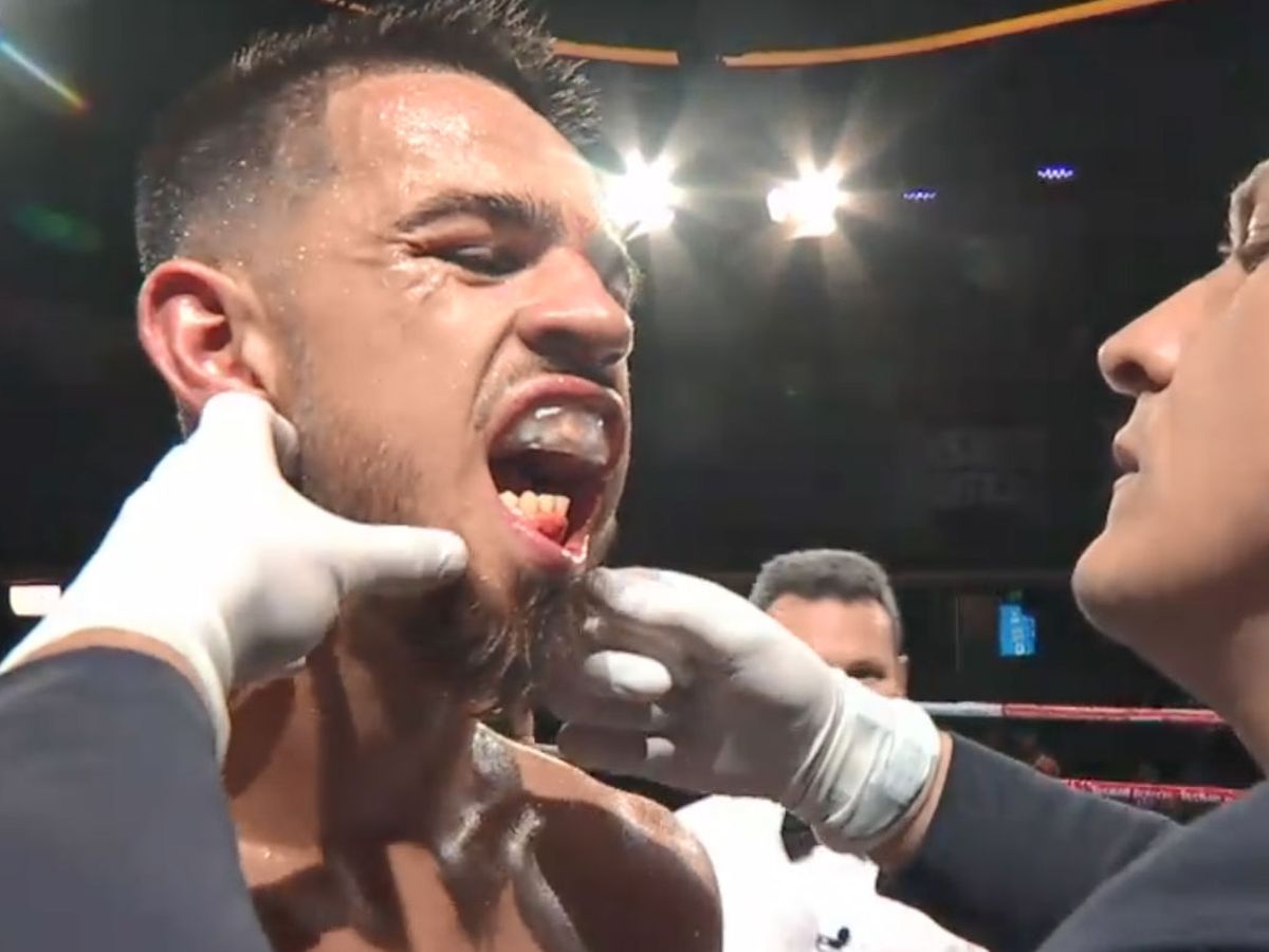 Boxing news, Benjamin Hussain broken jaw fight