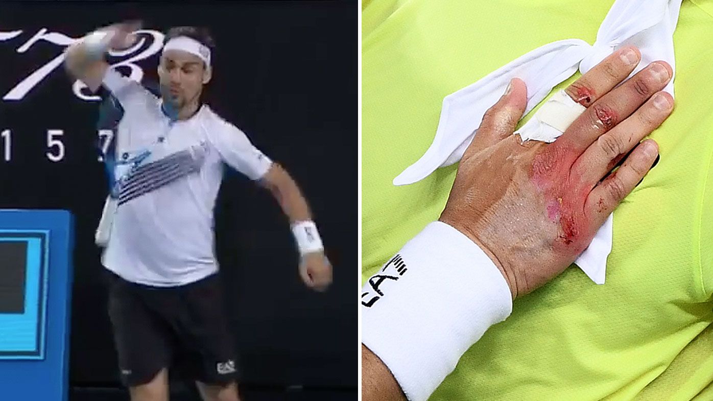 Fabio Fognini injures hand again with bizarre racquet smash 