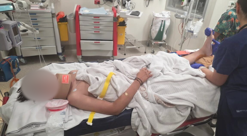 O jovem de 13 anos foi levado ao hospital com ferimentos graves, incluindo fraturas no crânio, perna gravemente quebrada e nariz quebrado.