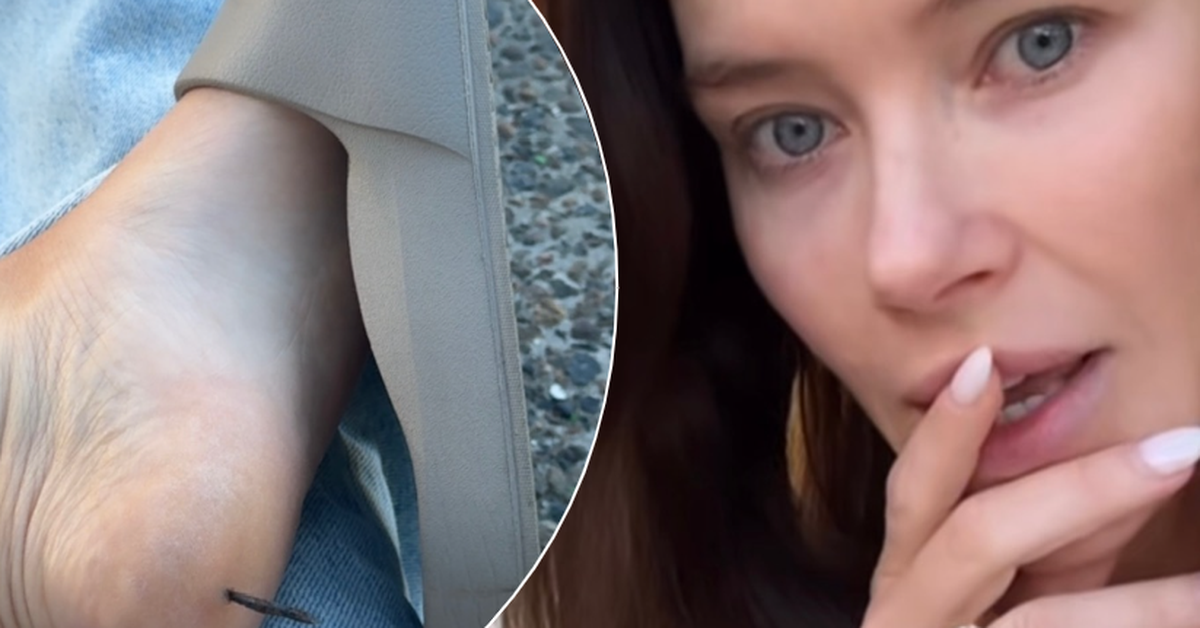 Brittany Hockley reveals gruesome injury as she gets a nail stuck in her foot