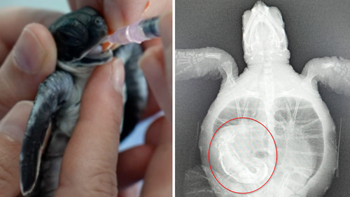 Large pieces of plastic had to be removed by hand from the turtle's digestive tract