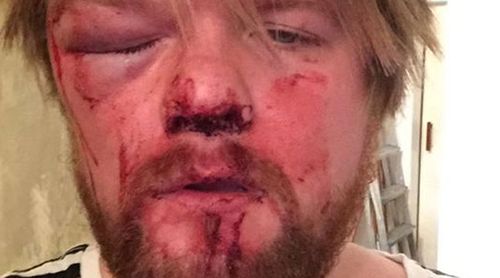 Man brutally bashed by thugs over a slice of pizza
