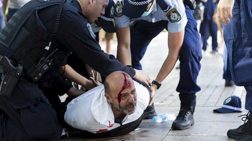 A man is seen bleeding profusely from a head wound incurred during a dramatic arrest in Hyde Park.