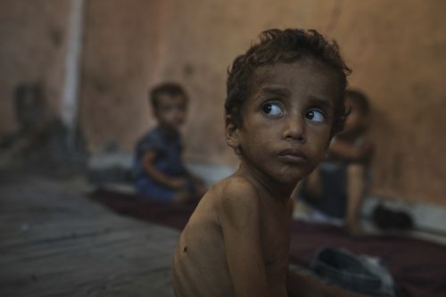 Yazan Abu Ful, a 2-year-old malnourished child, sits at his family home in the Shati refugee camp in Gaza City on Wednesday, July 23, 2025. (AP Photo/Jehad Alshrafi)